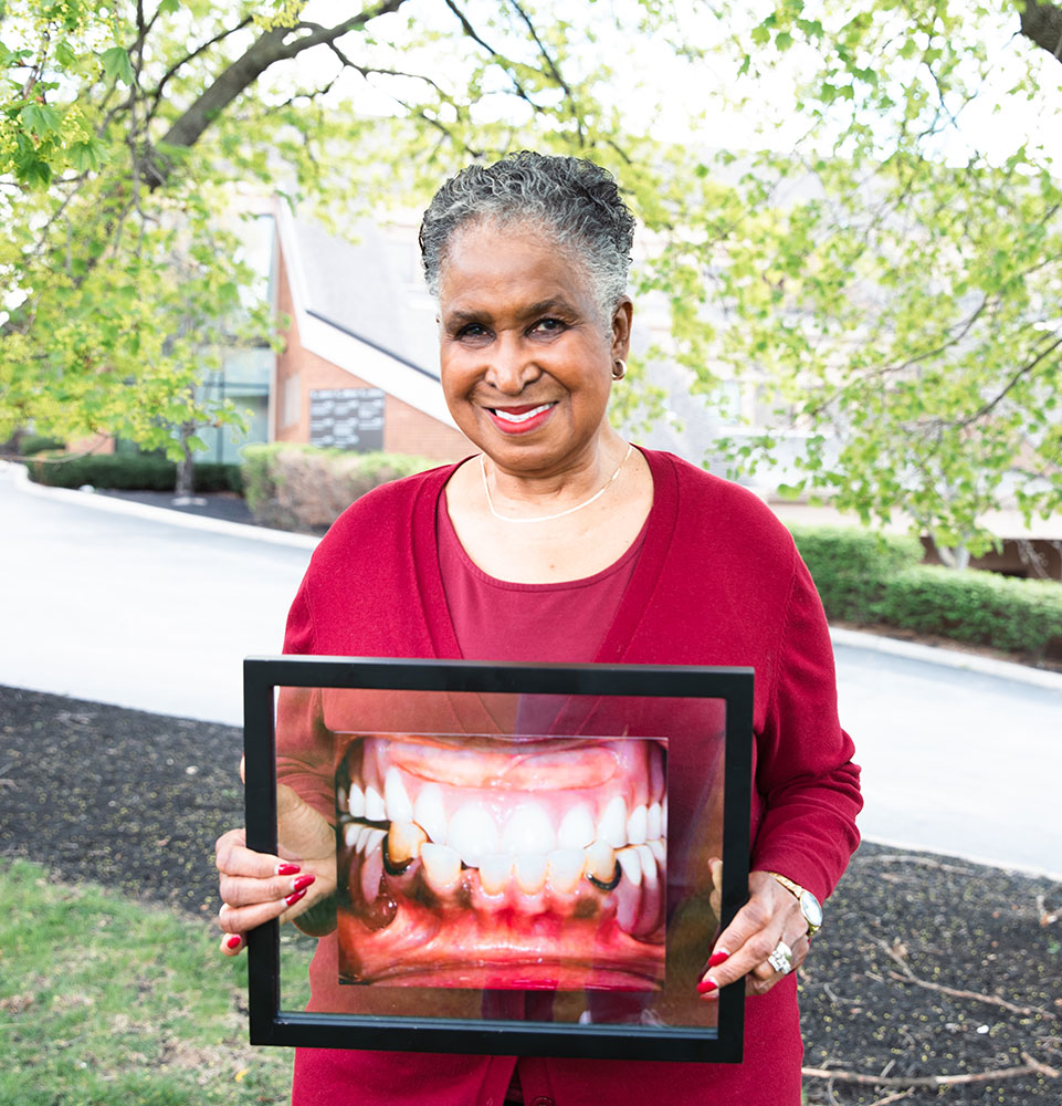 dental implant patient smiling